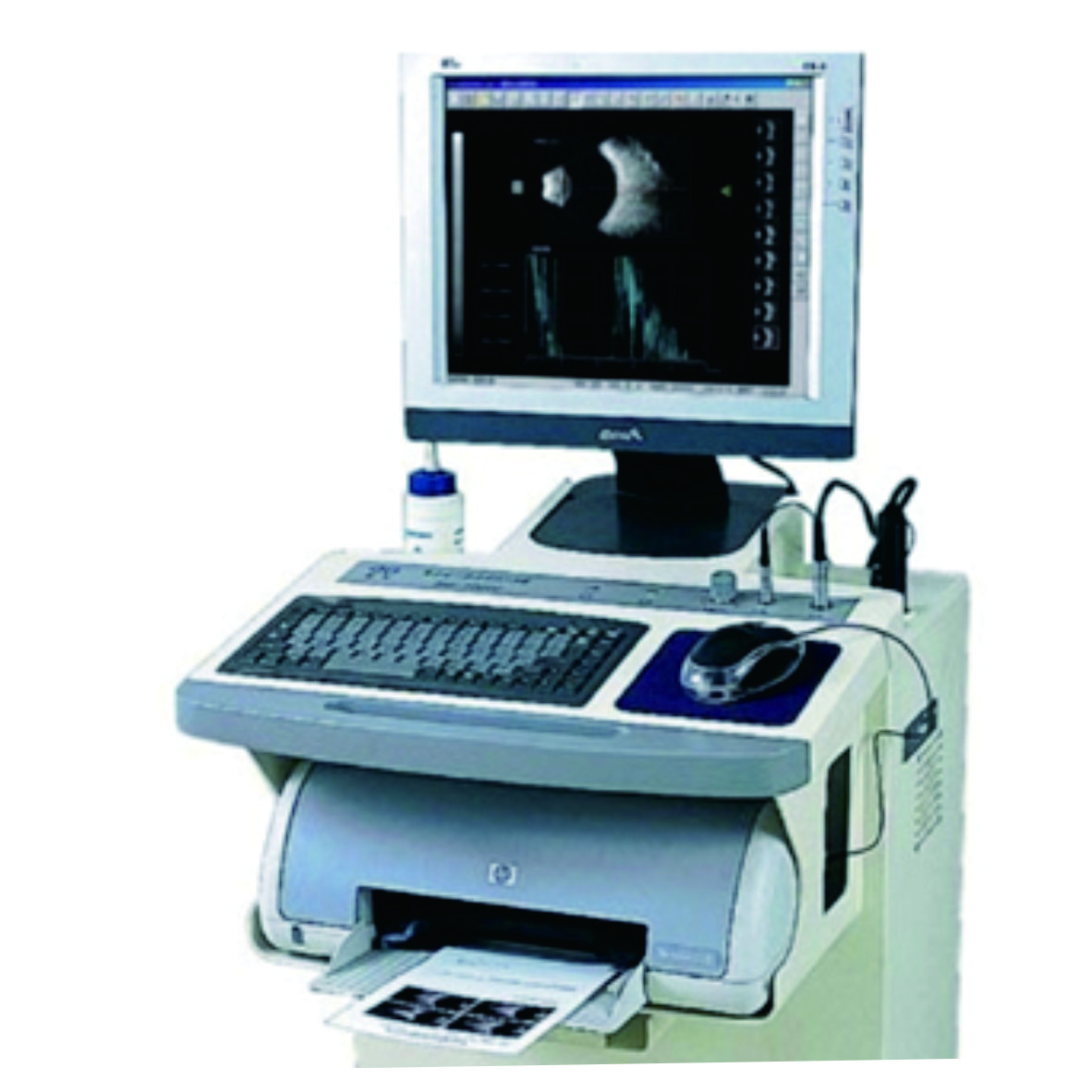 CAS-2000BER (MODEL B) A/B scan